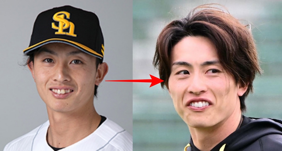 周東佑京の昔と現在の歯の比較画像