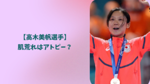 高木美帆　アトピー　アイキャッチ