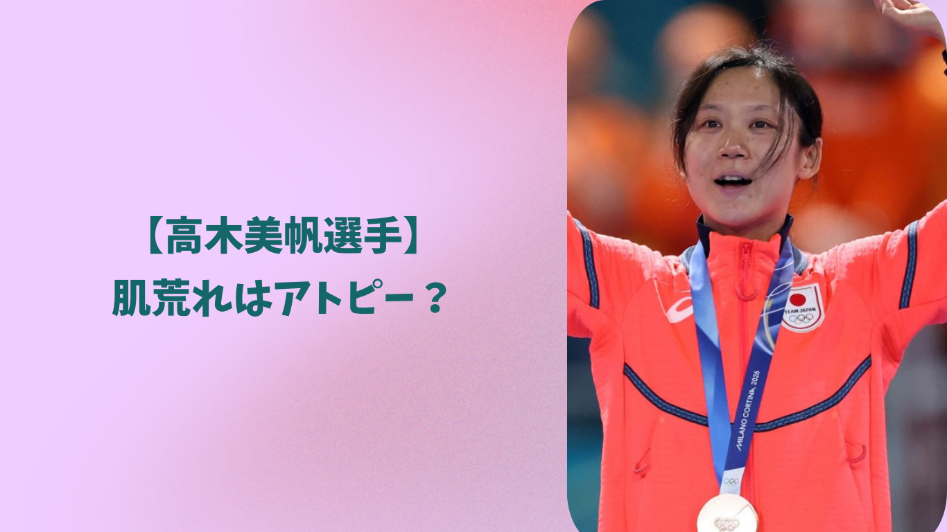 高木美帆　アトピー　アイキャッチ